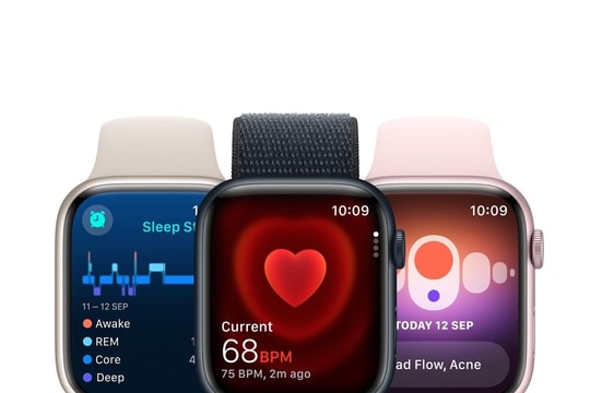 Tổng hợp top Apple Watch đáng tiền, tích hợp nhiều tính năng nhất 2025